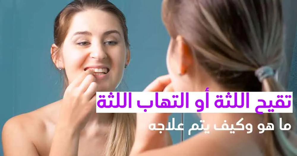 تقيح اللثة أو التهاب اللثة ما هو وكيف يتم علاجه